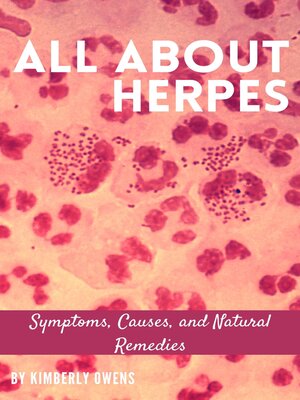 cover image of ALL ABOUT HERPES